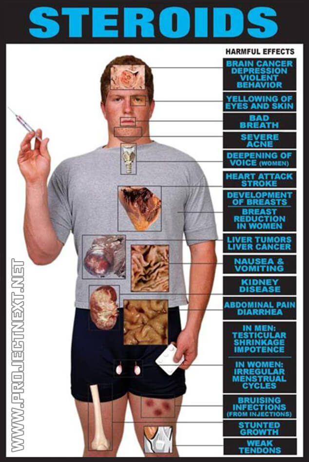 Steroids Harmful Effects - Healthy Fitness Bad Breath Acne Skin