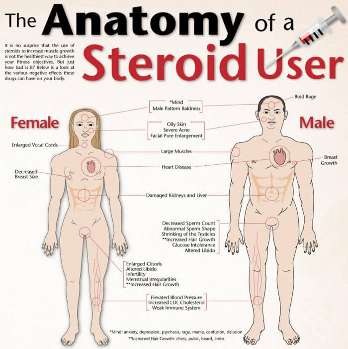 The Anatomy Of A Steroid User - Effects Of Steroids Female Male